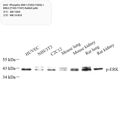 Anti-fosfo-ERK1 (T202\/Y204) + ERK2 (T185\/Y187) PAB de conejo